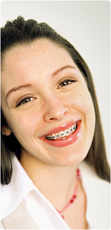 Frequently Asked Orthodontic Questions