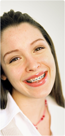 Common Orthodontic Questions