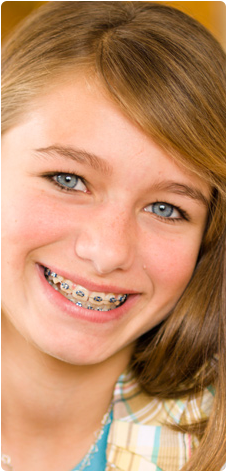 The Right Age for Braces